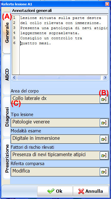 Con Dermatec si può redigere il referto sulla lesione semplicemente selezionando una diapositiva a caso che rappresenta la lesione interessata. La morfologia e le caratteristiche della rete vascolare e della pigmentazione possono infatti essere facilmente osservate e valutate secondo criteri diagnostici o pattern in modo da orientare una precisa diagnosi differenziale delle lesioni.